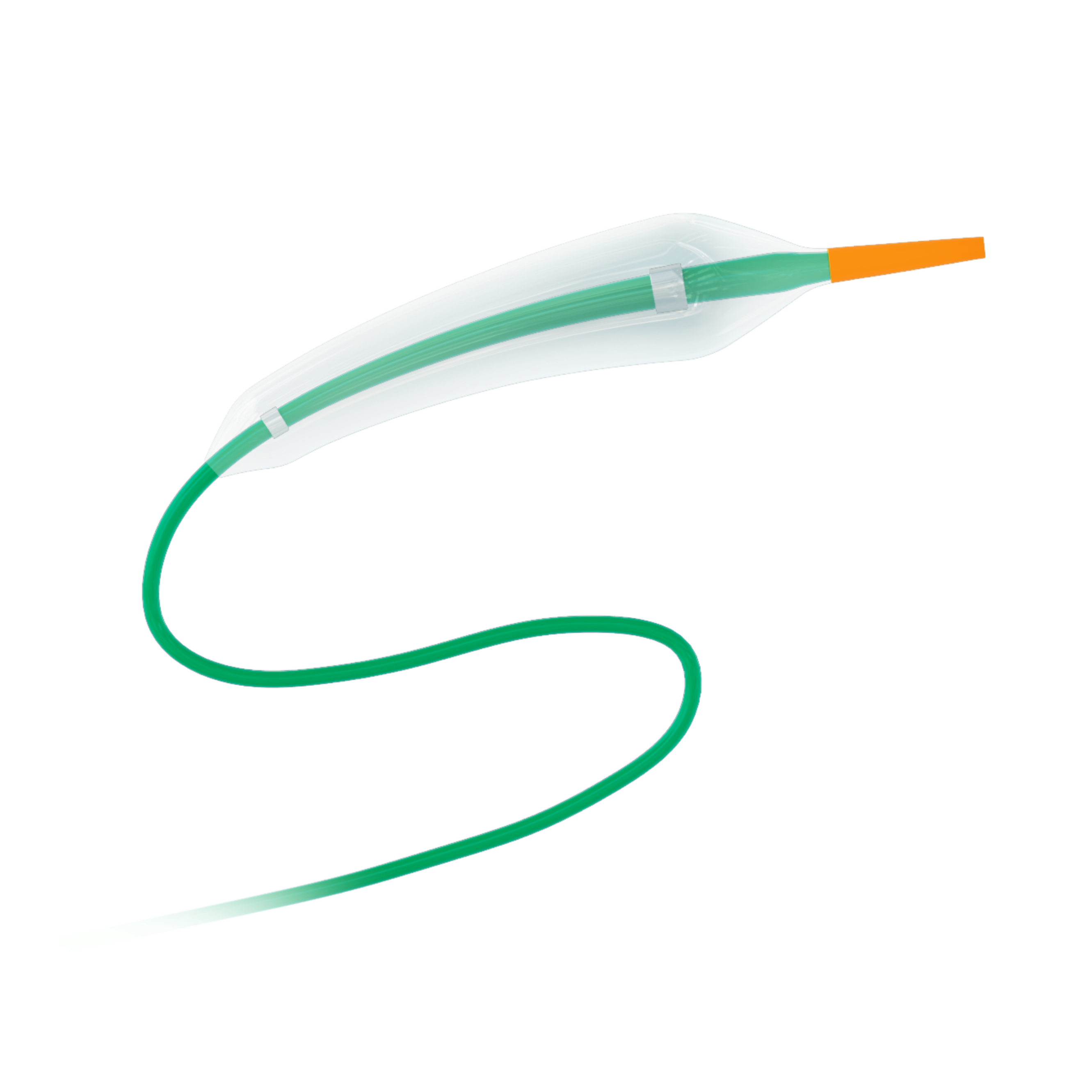 非順應(yīng)性冠狀動脈球囊擴(kuò)張導(dǎo)管